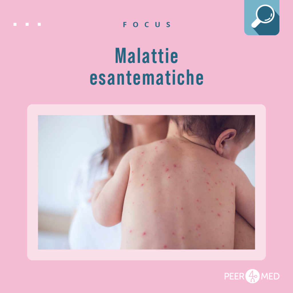 immagine di un bambino, in braccio alla mamma, con una malattia esantematica