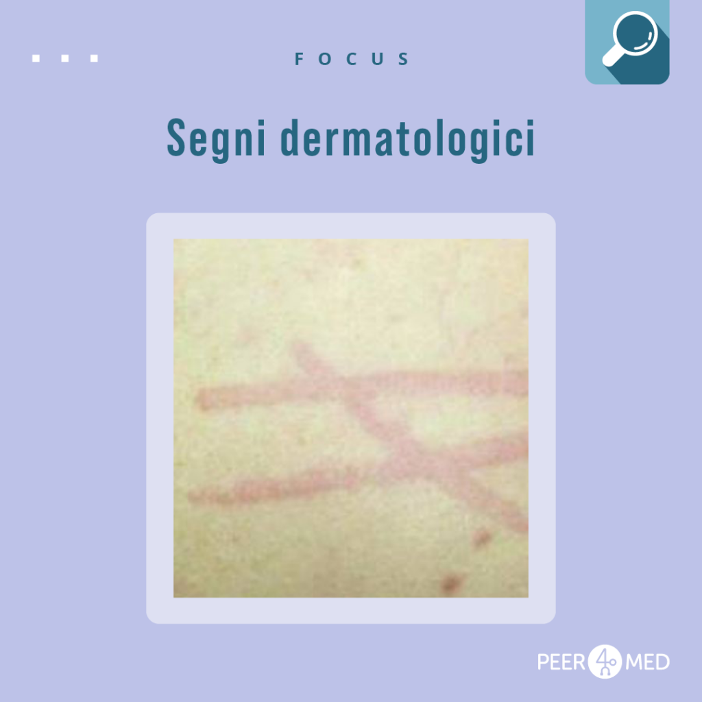 Fotografia di un segno dermatologico di una malattia