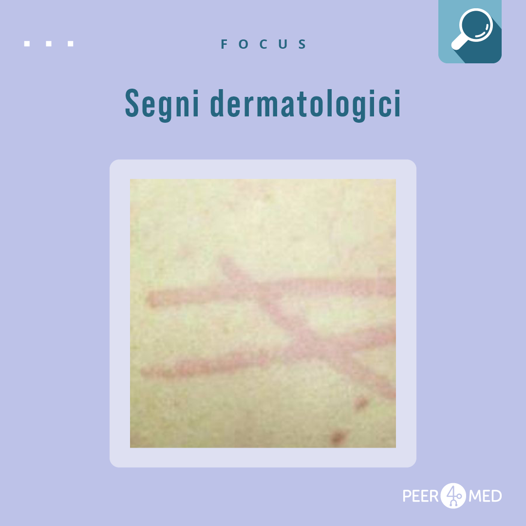 Fotografia di un segno dermatologico di una malattia