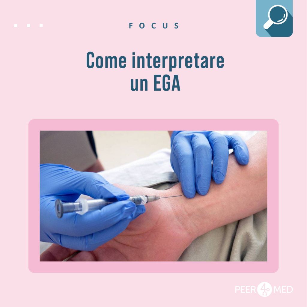 come interpretare ega