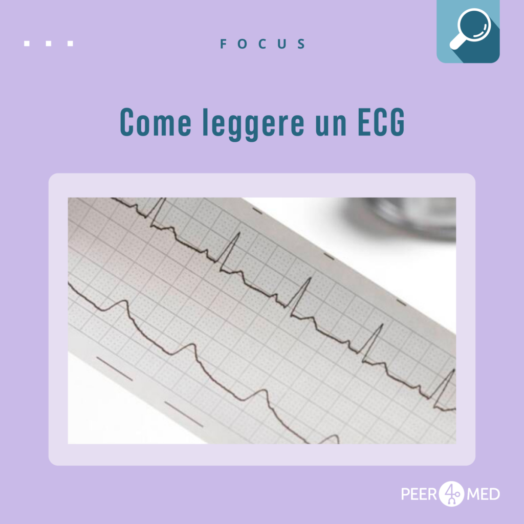 come leggere ECG